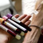 Asking Why: Daily Bloodwork at PHC, Dr. Janet Simons